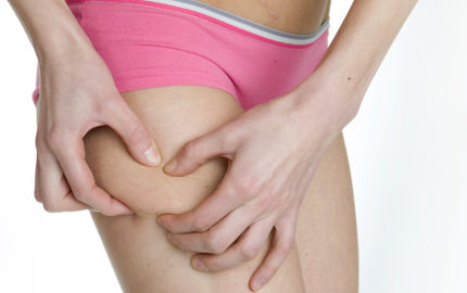 bli av med celluliter snabbt bli av med celluliter snabbt