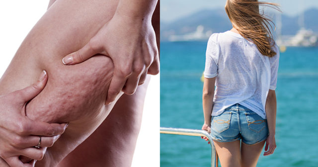 få bort celluliter på benen få bort celluliter på benen