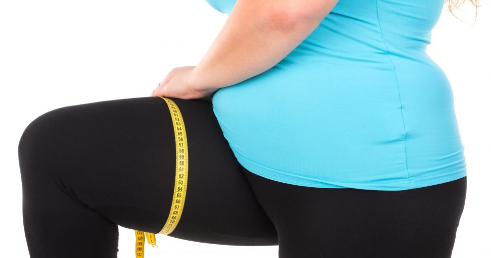 Lipödem - kvinnosjukdomen ges ofta fel behandling | MåBra