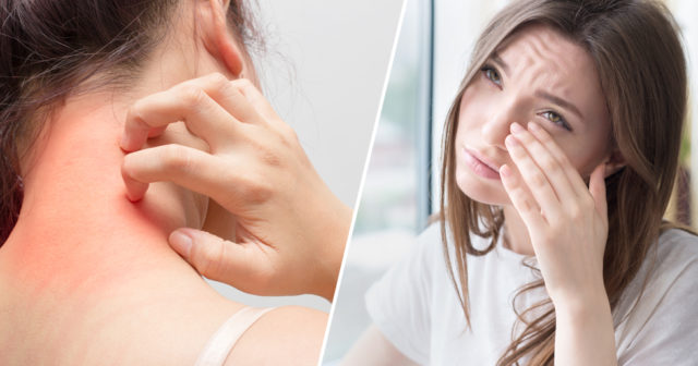 pollenallergi medicin receptbelagda pollenallergi medicin receptbelagda